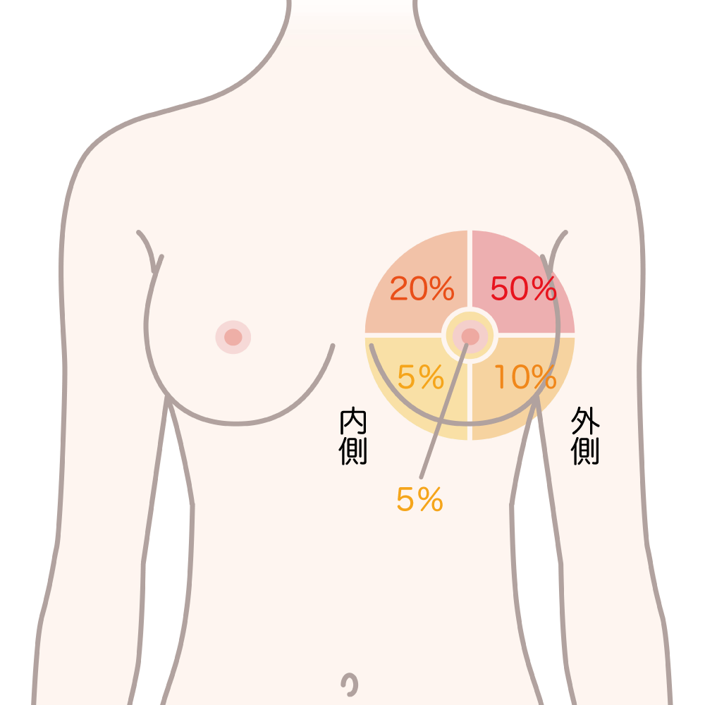 乳癌の好発部位