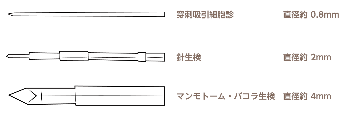 組織診（針生検、マンモトーム生検、バコラ生検など）