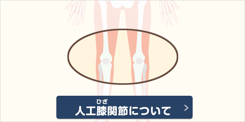 病院 股関節 専門